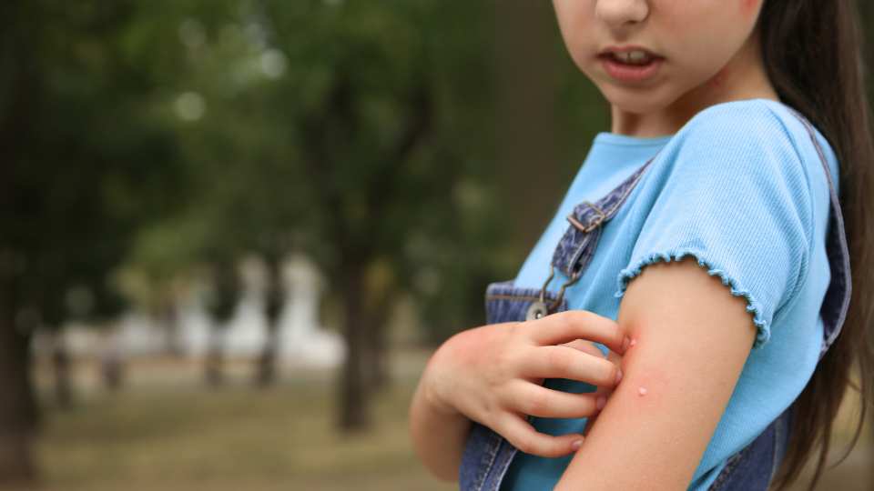 infected insect bites
