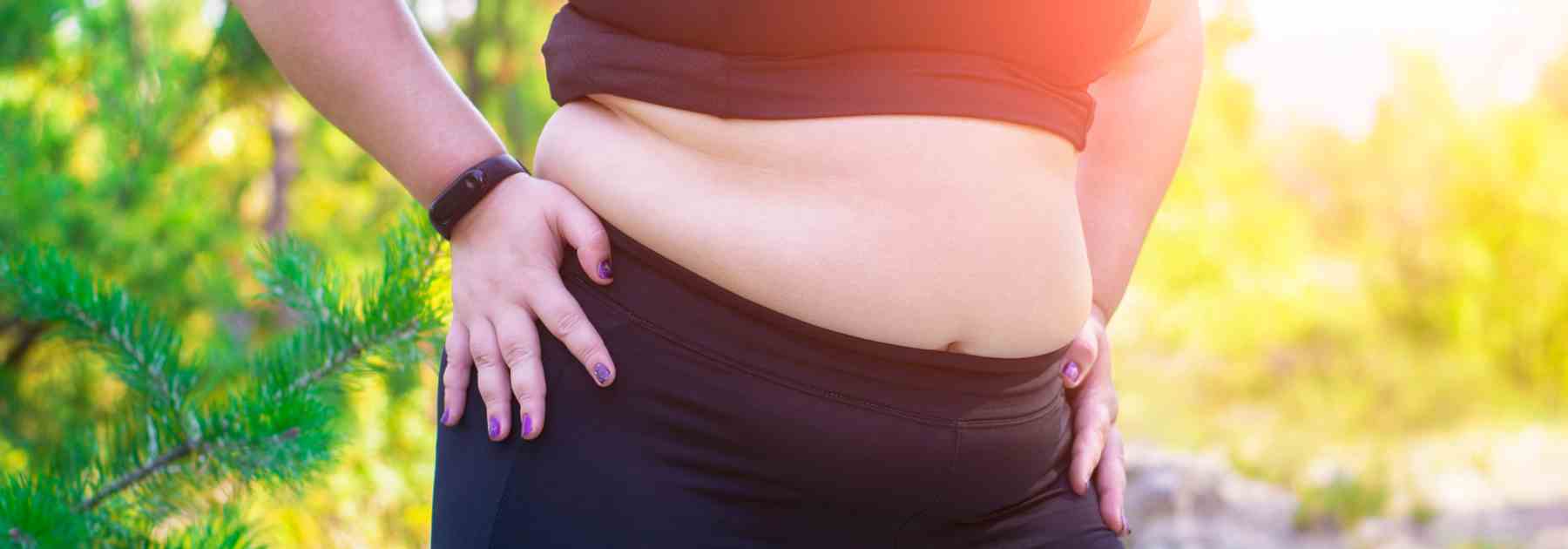 Obese stomach before weight loss