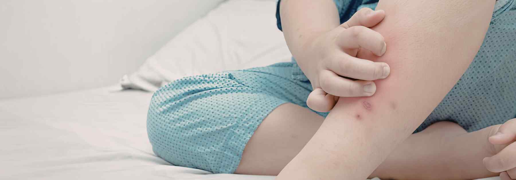 Itching an infected insect bite